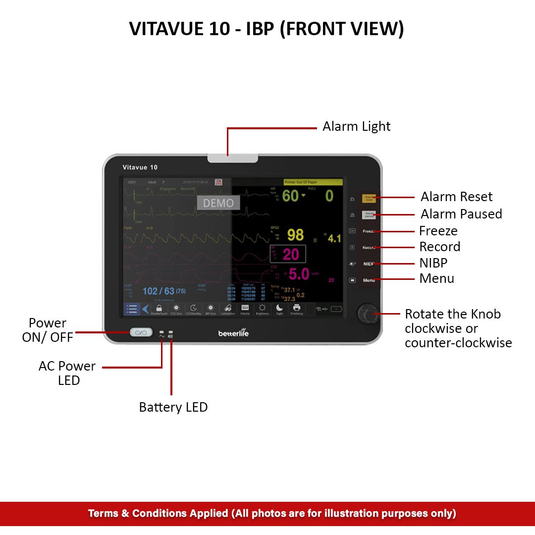 photo_6269260515712372070_y